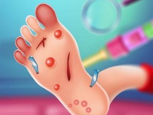 Tiny Healers: Foot Clinic